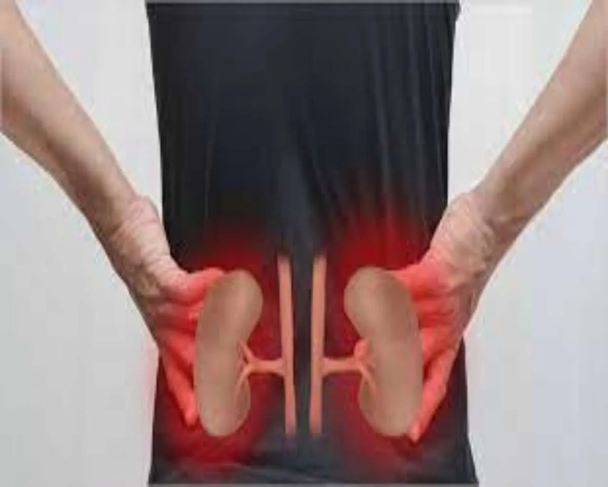 Kidney
