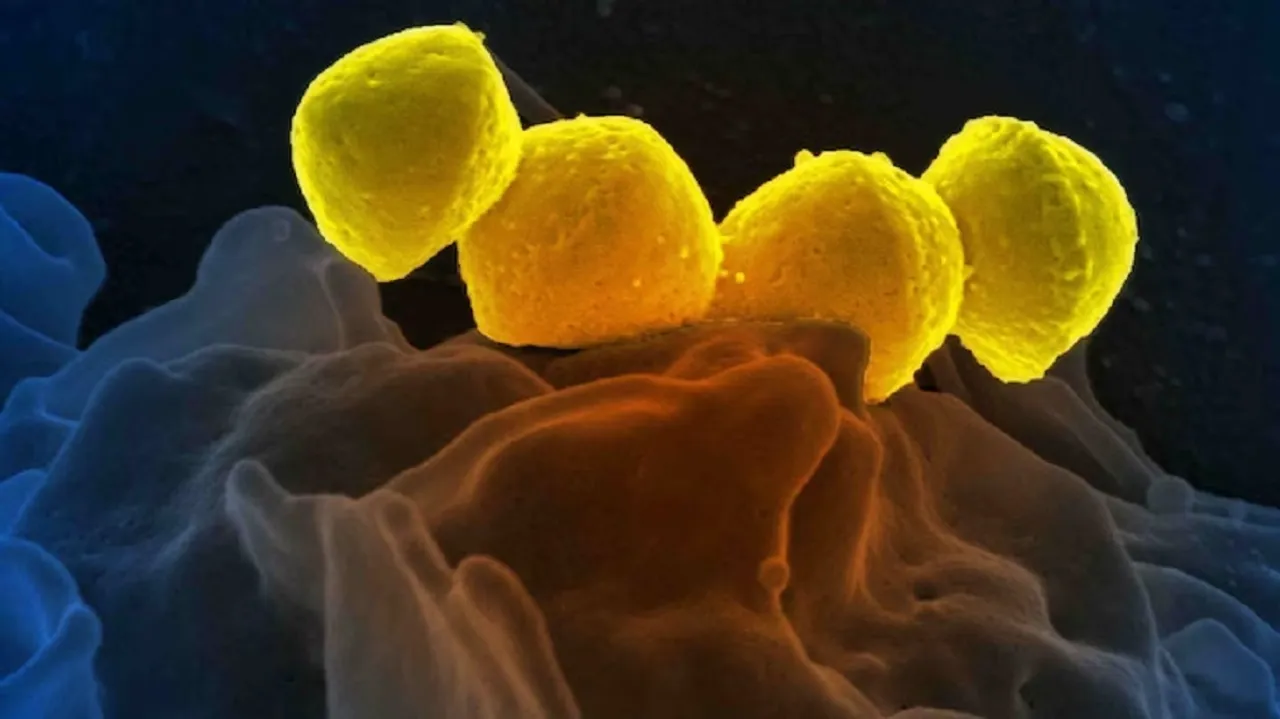 bacteria 