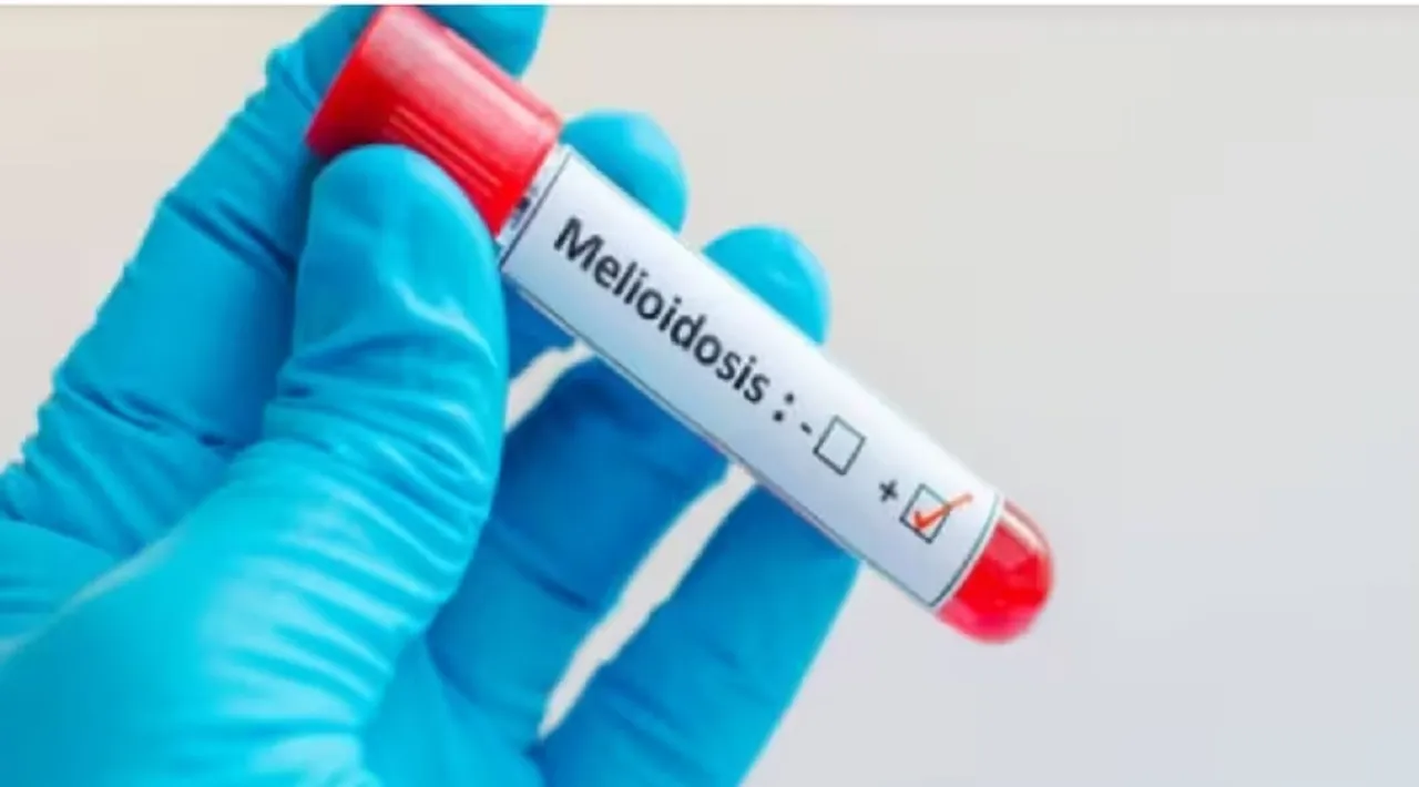 melioidosis