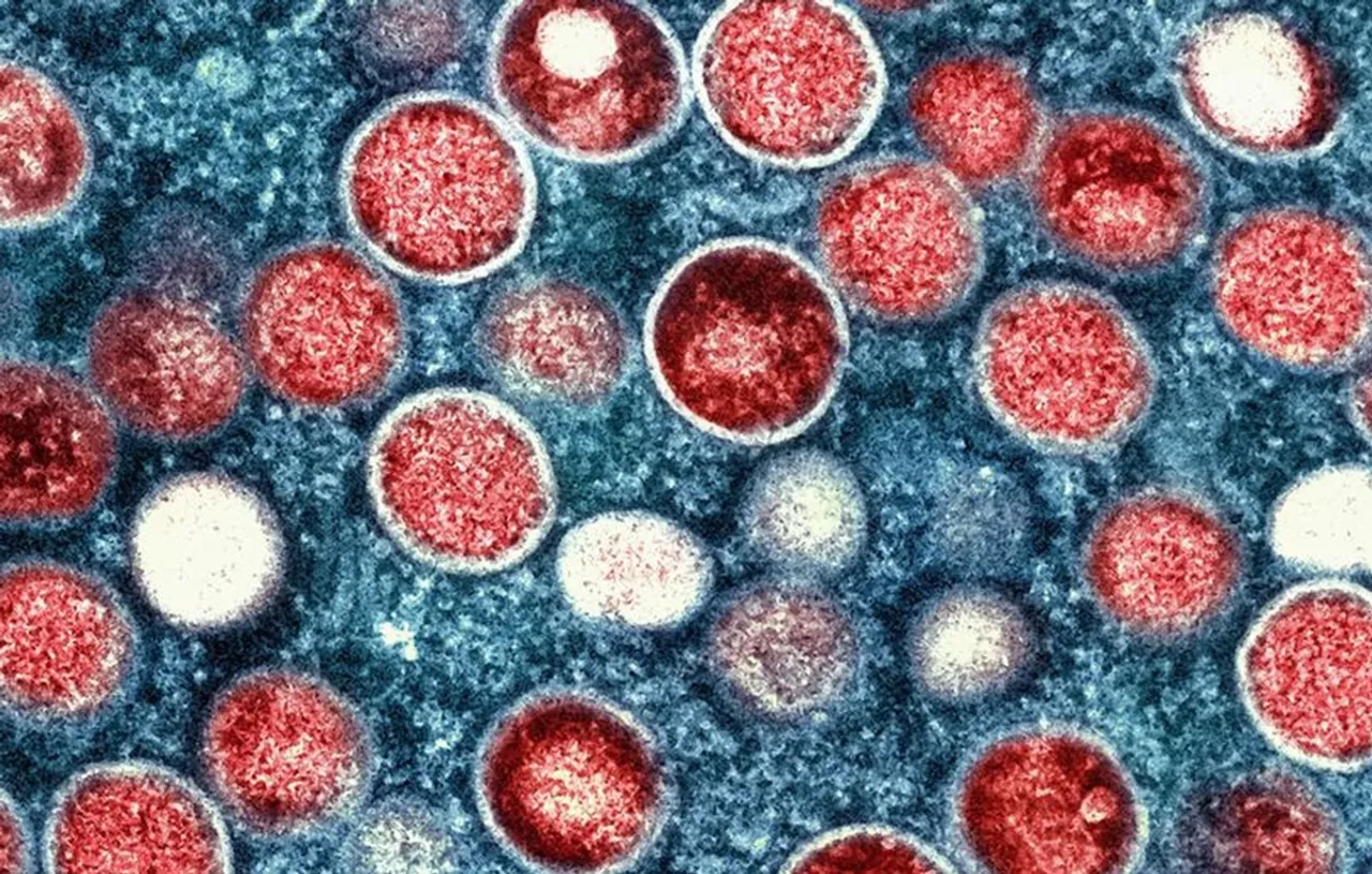 mpox