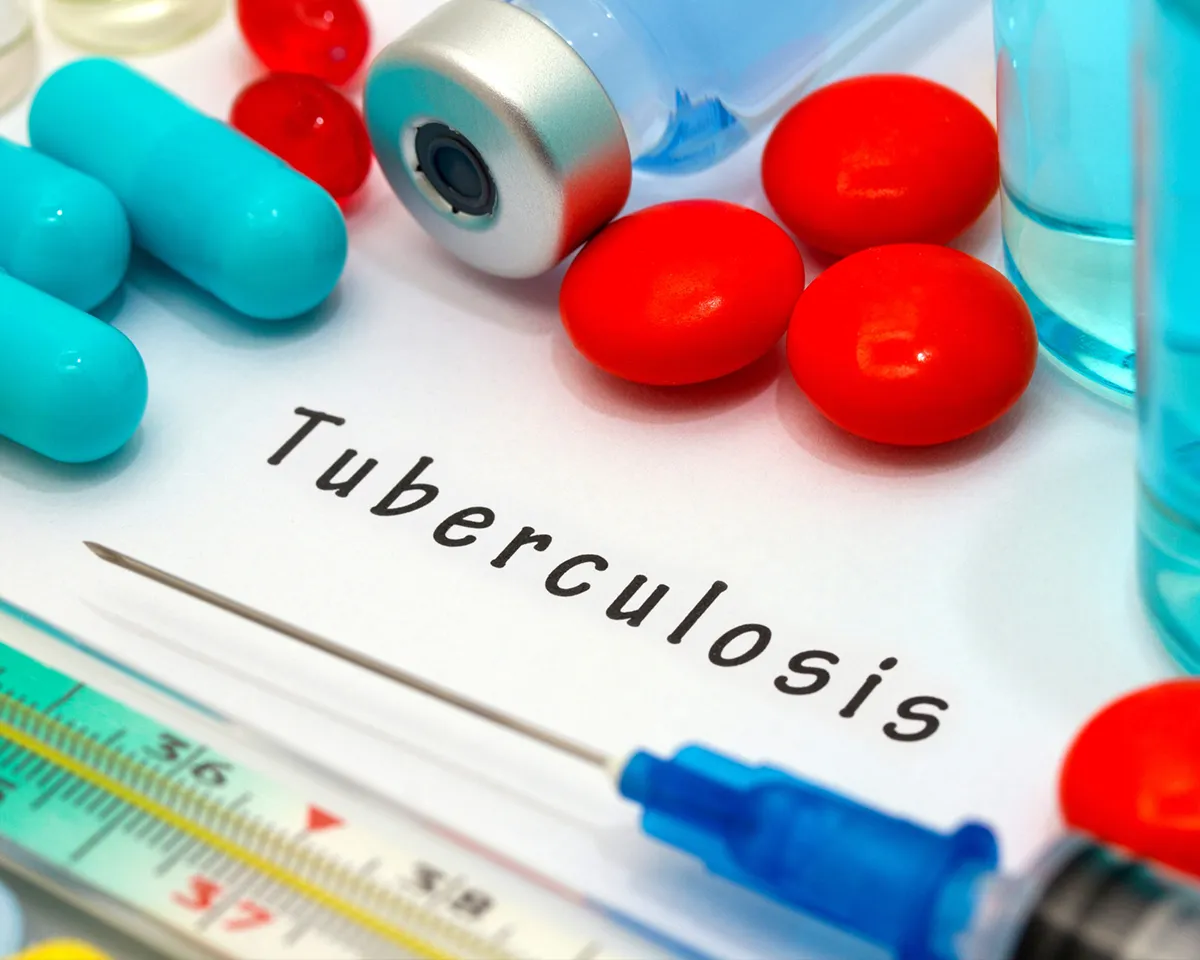 tuberculosis