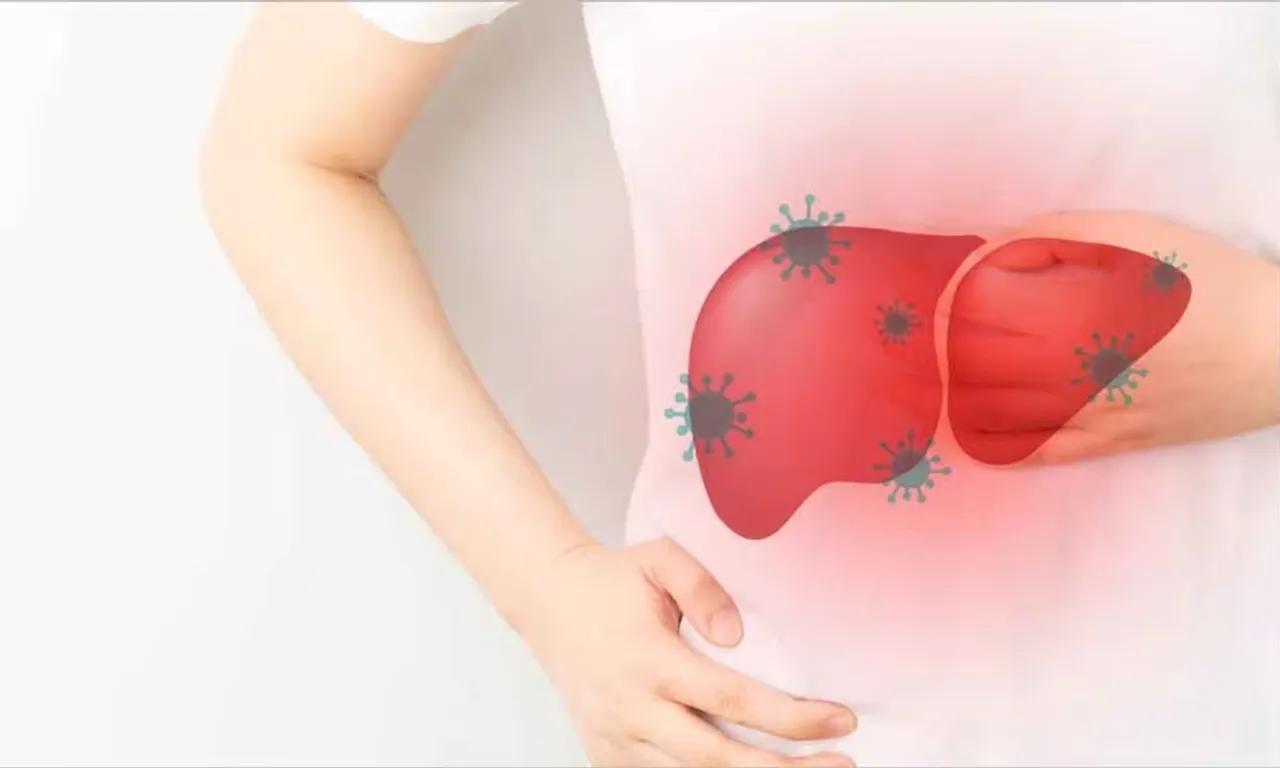 hepatitis