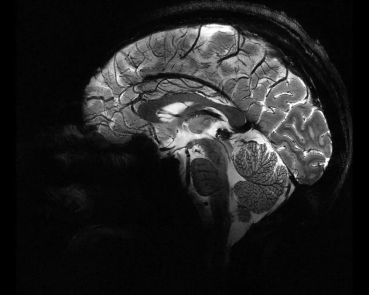 mri