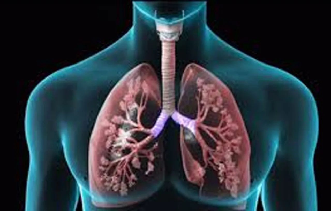 copd