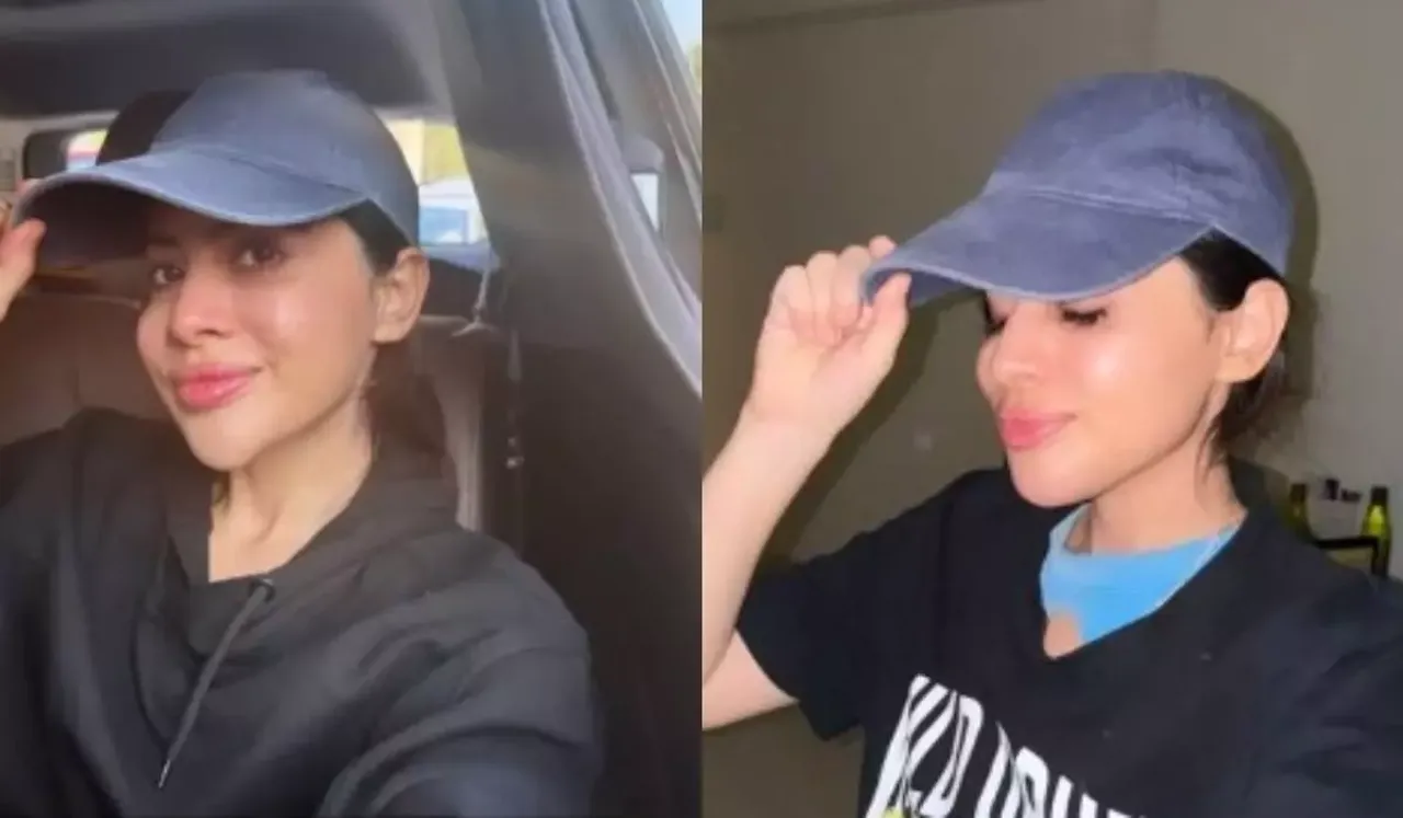 Uorfi Javed Shares Decision To Dissolve Chin Fillers, See Before-After