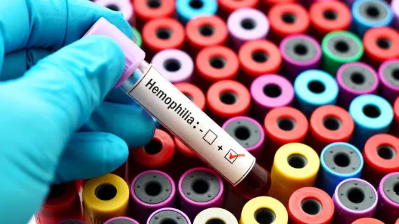 haemophilia
