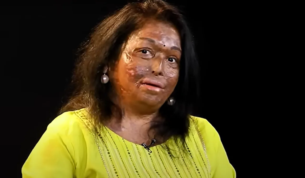 Sneha Jawle Burns Survivor