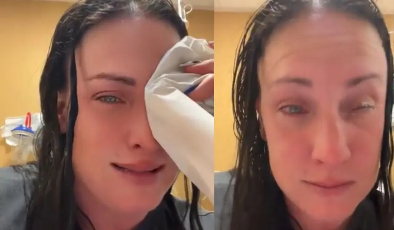 Woman Mistakes Superglue For Eye Drops