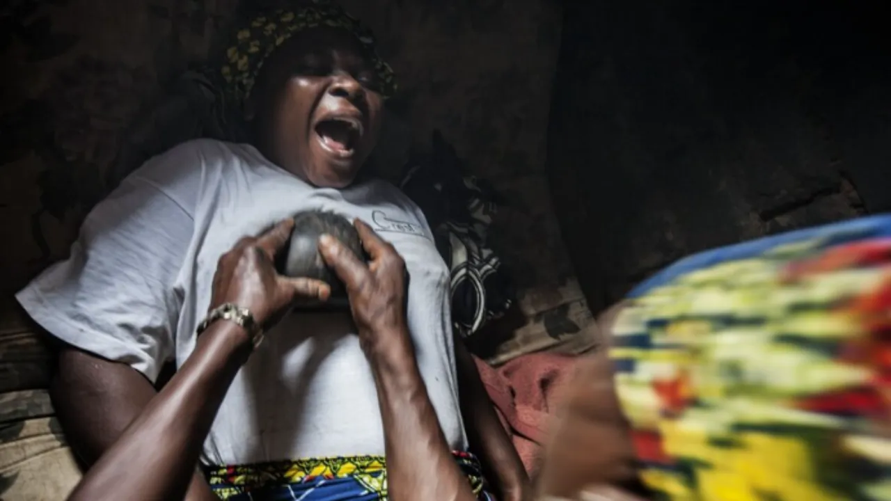 breast ironing