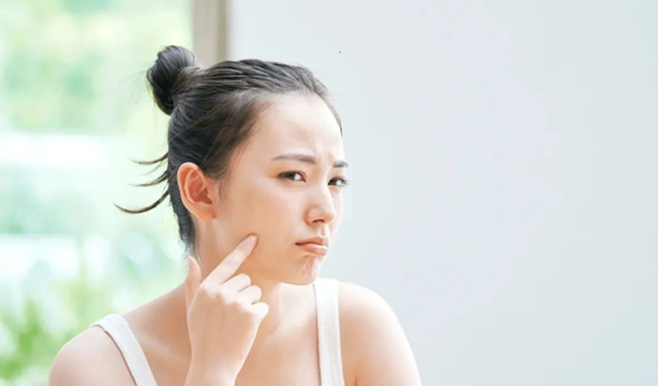 skin problem
