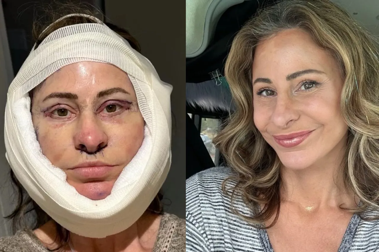 Kelly Beasley, 50, sold her house to go under the knife