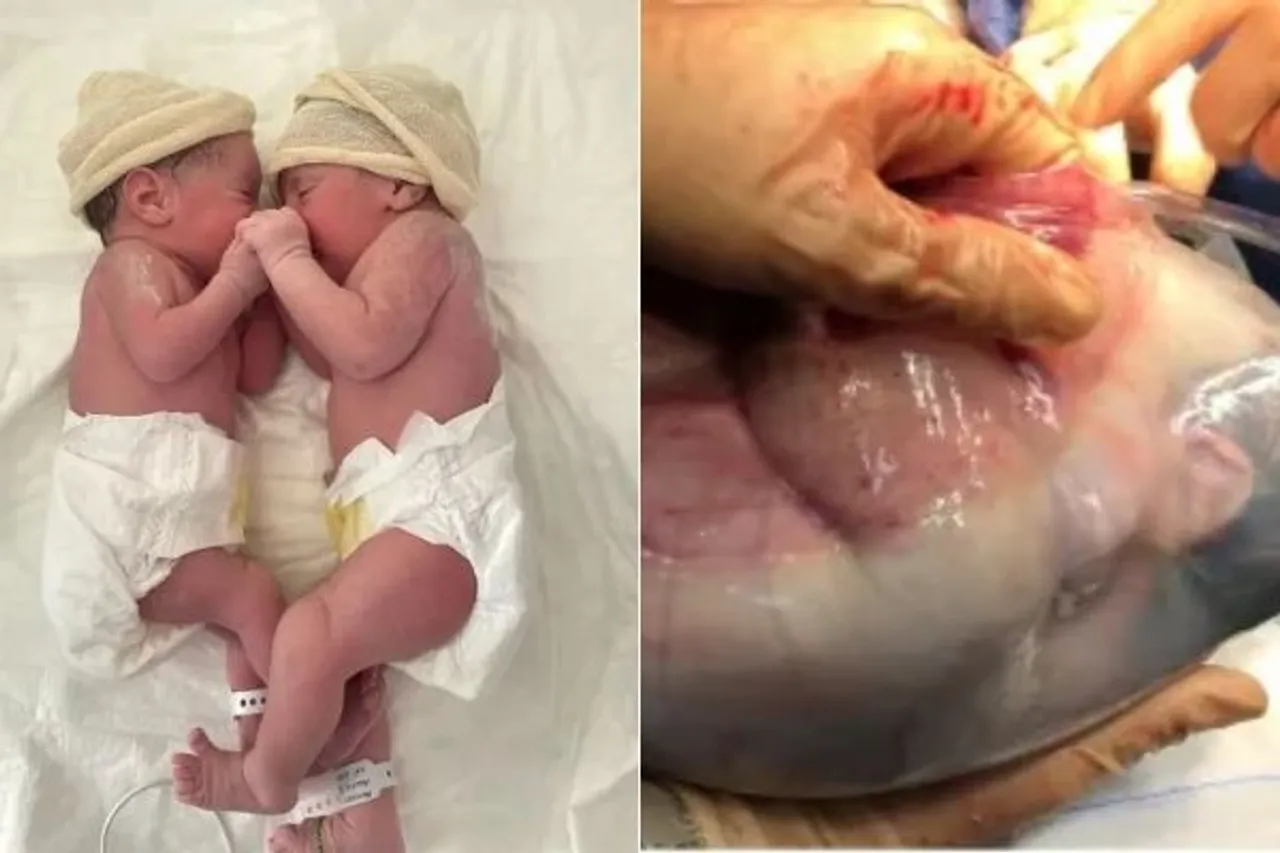 what is mermaid birth