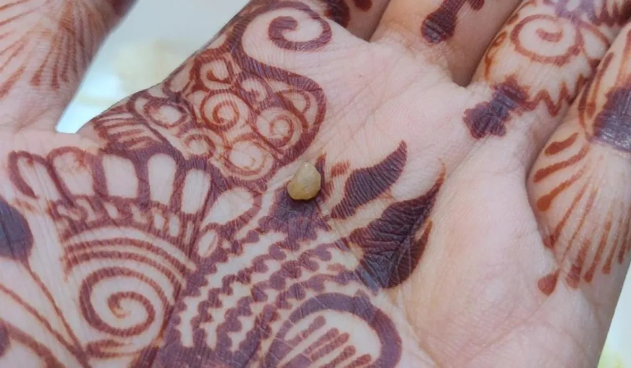 Woman Finds Stone In Meal Served At Airport Lounge