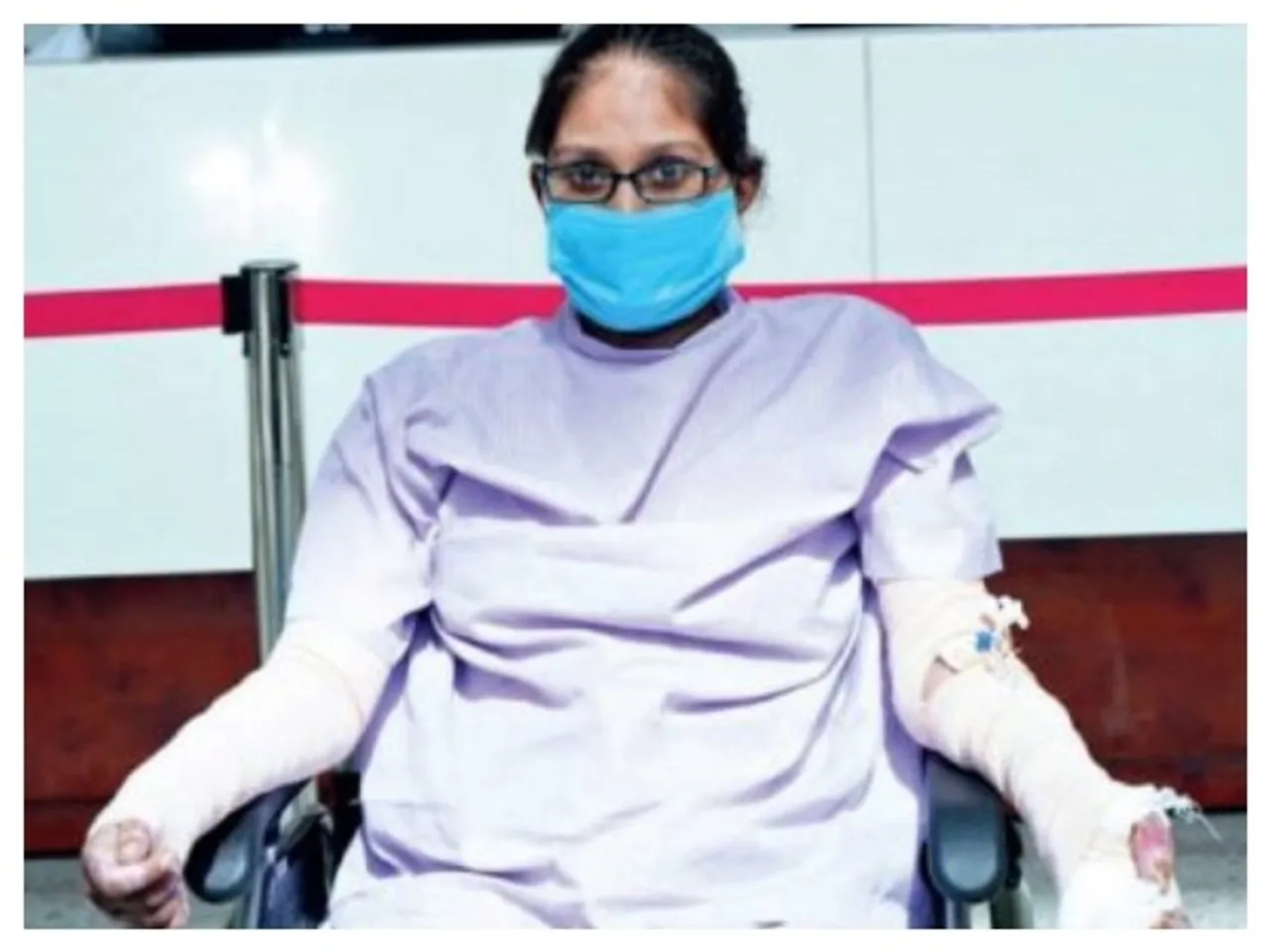 Misbah Kharawala burnt