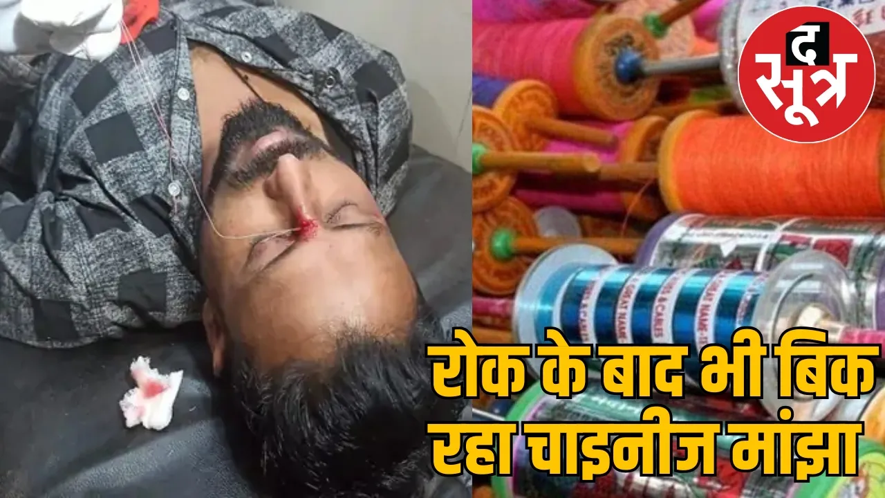 Bhilai Power House A young man face cut by Chinese manjha the sootr