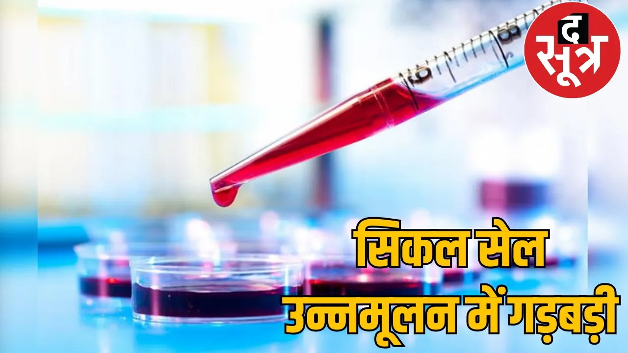 No reagents yet 1.5 crore people were tested Chhattisgarh's condition regarding sickle cell