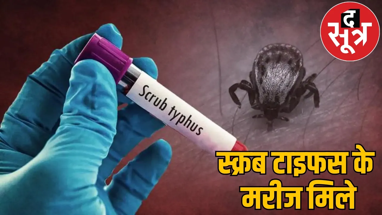 Scrub typhus disease knocked in Chhattisgarh