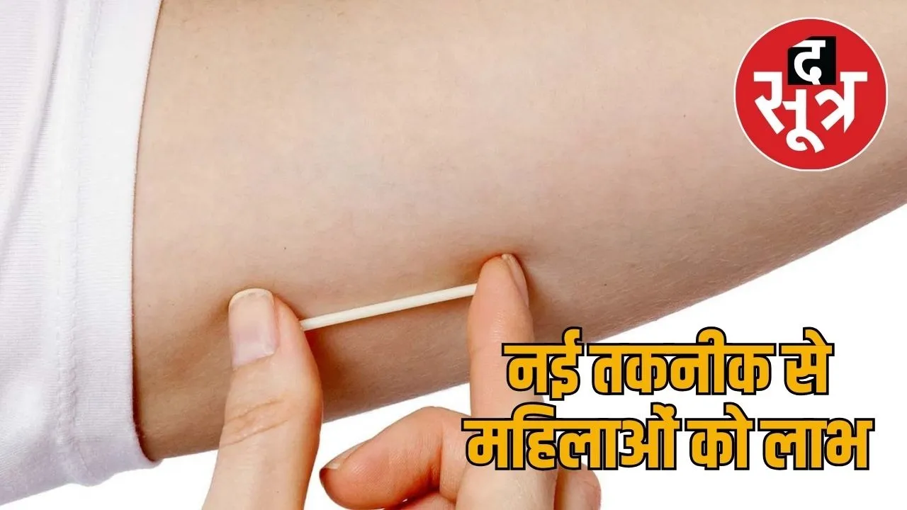 implant