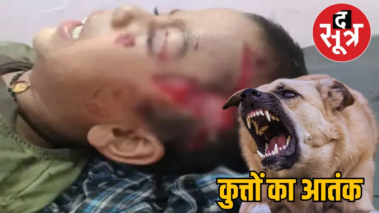 dog bit several children in 48 hours in chhattisgarh