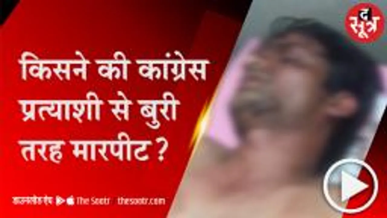 GUNA:कांग्रेस प्रत्याशी पर जानलेवा हमला, लाठियों से बुरी तरह पीटा; बचाने आए मां और भाई से भी की मारपीट 
