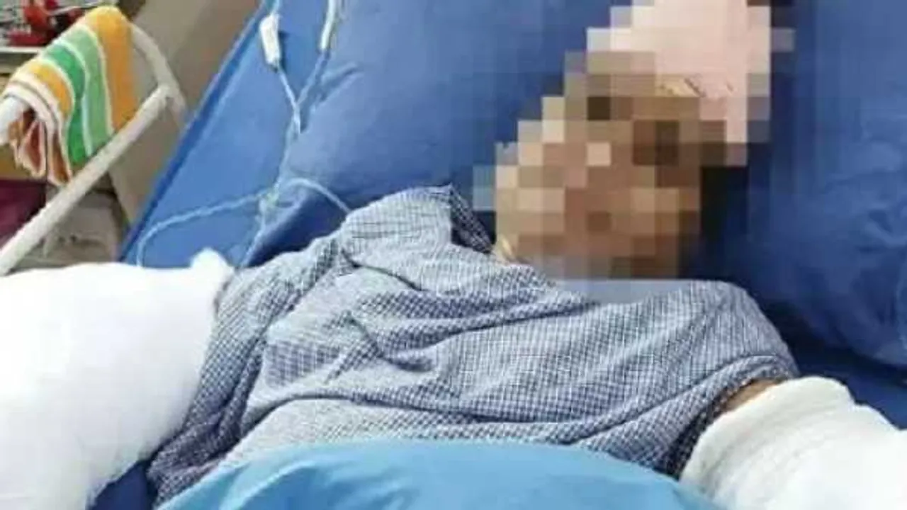 कट गई थी दोनों हाथ की कलाई, डॉक्टरों ने फिर जोड़ा, ससुर ने किया था बहू पर तलवार से वार