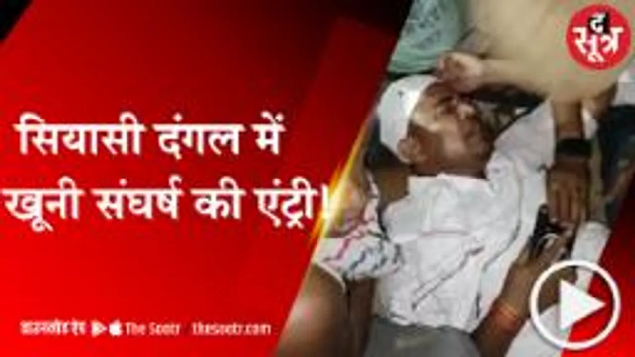 REWA: वार्ड में शराब बांटने का विरोध करना पड़ा भारी, कांग्रेस प्रत्याशी के पति पर हुआ जानलेवा हमला 