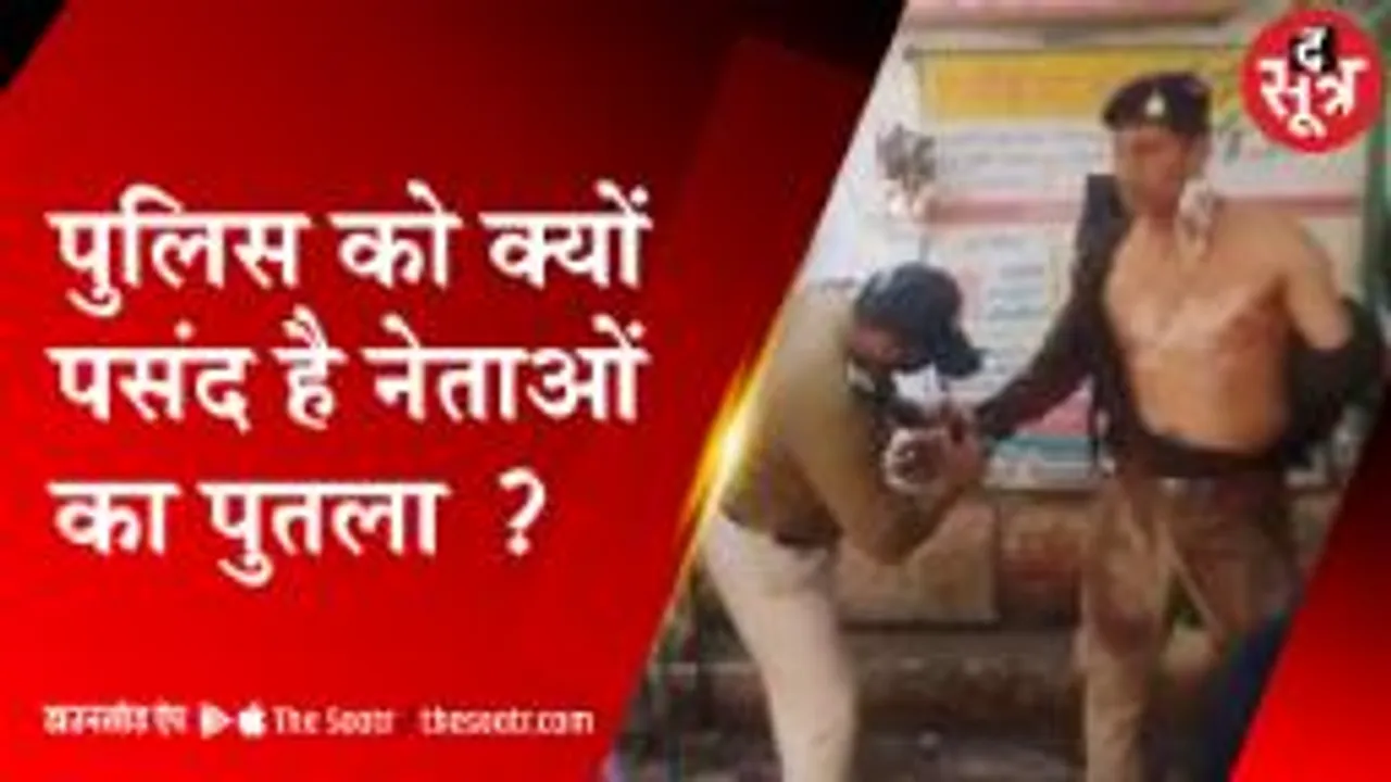 पुतला दहन में झुलसे ASI को दिल्ली भेजा, धारा 307 के तहत 5 कांग्रेसी गिरफ्तार