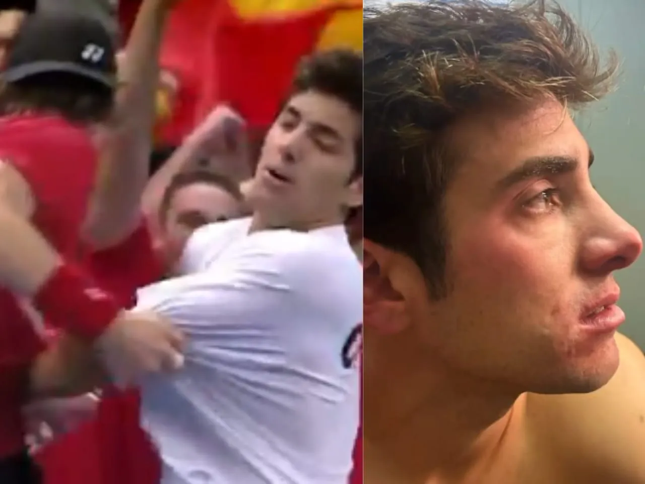 Zizou Bergs wild celebration leads to Cristian Garin's injury