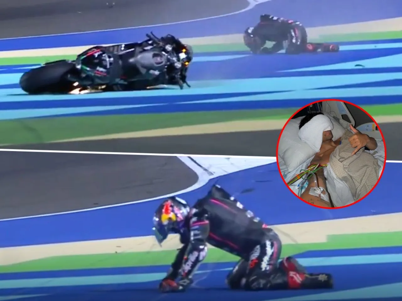 Jorge Martin had a rib fracture after crashing at the 2025 Qatar GP in Lusail