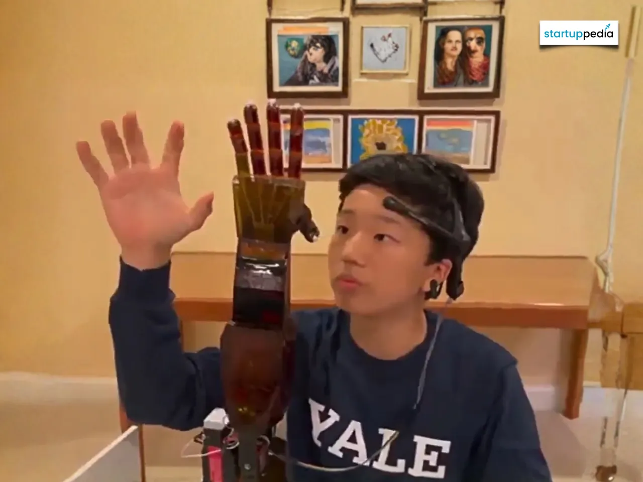 mind-controlled prosthetic arm