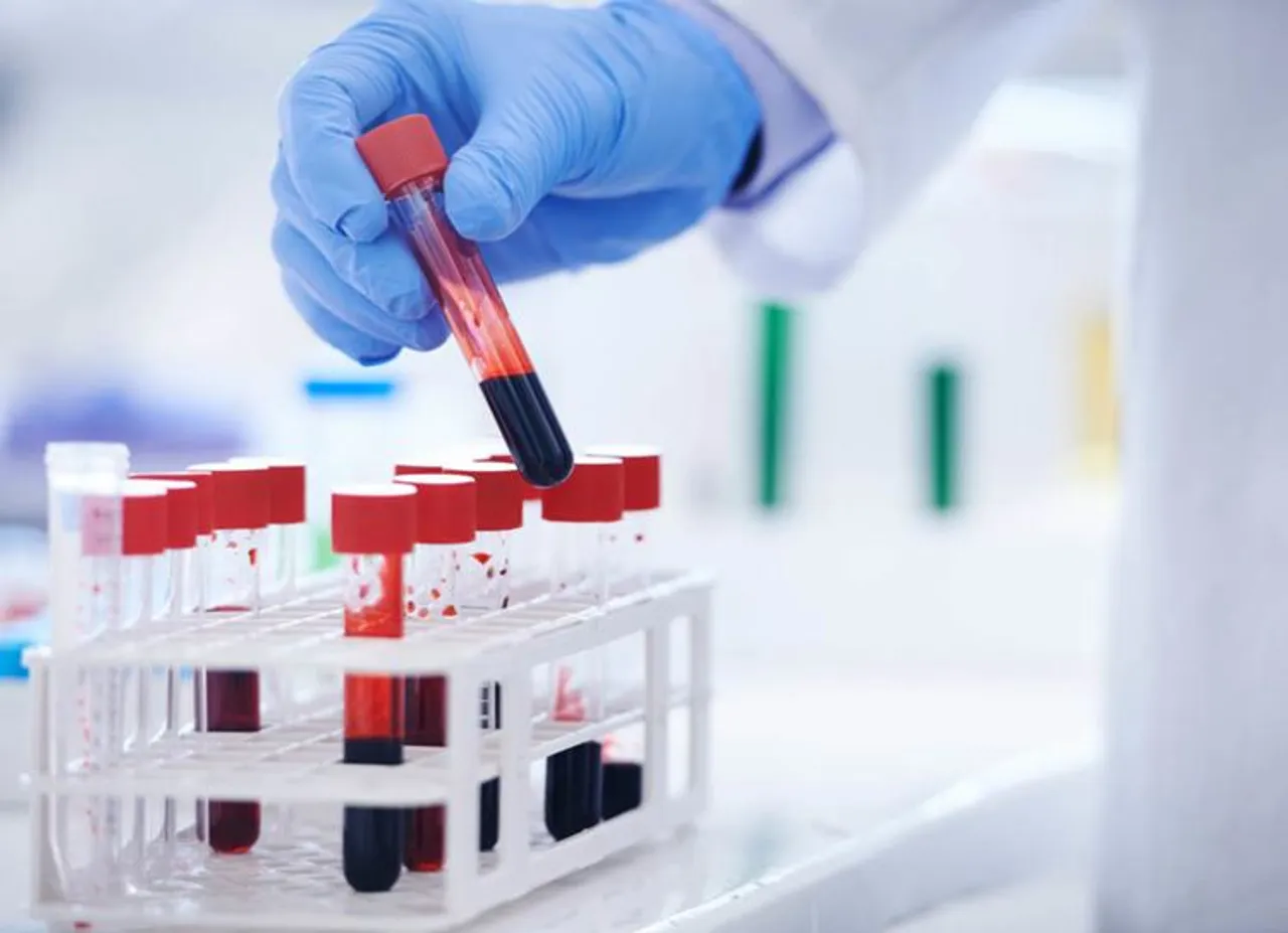 HIV Infected Tamil Nadu Woman