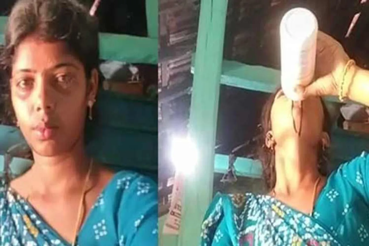 tiktok, video, tiktok video, poisoning, suicide, woman, டிக்டாக், வீடியோ, பெண், தற்கொலை