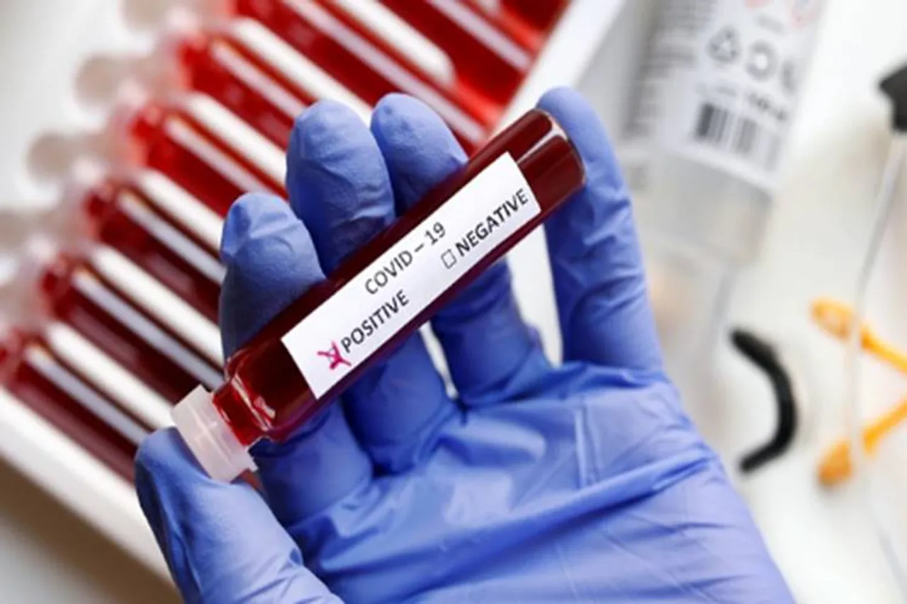 2 women tests corona positive, returned from varanasi