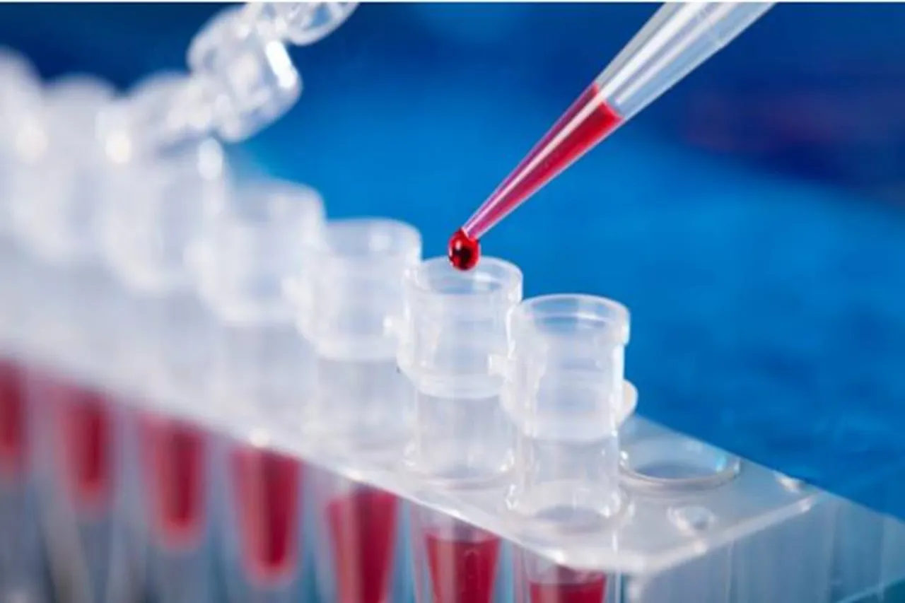 corona test samples lab technicians madras high court