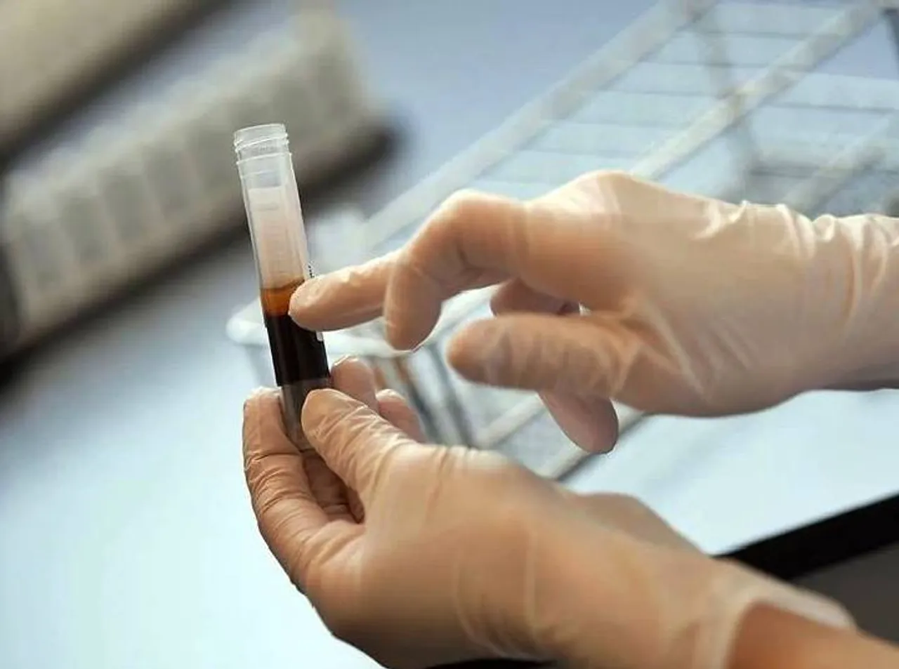 corona virus. Corona virus tamil news, Corona virus news in tamil, கொரோனா வைரஸ், கொரோனா தமிழ் news, கொரோனா தமிழ்நாடு, corona virus tamil nadu news, coronavirus today news in tamil, coronavirus Latest news in tamil, coronavirus Tamil nadu news, coronavirus chennai news, Corona virus outbreak, corona virus pandemic, corona virus symptoms