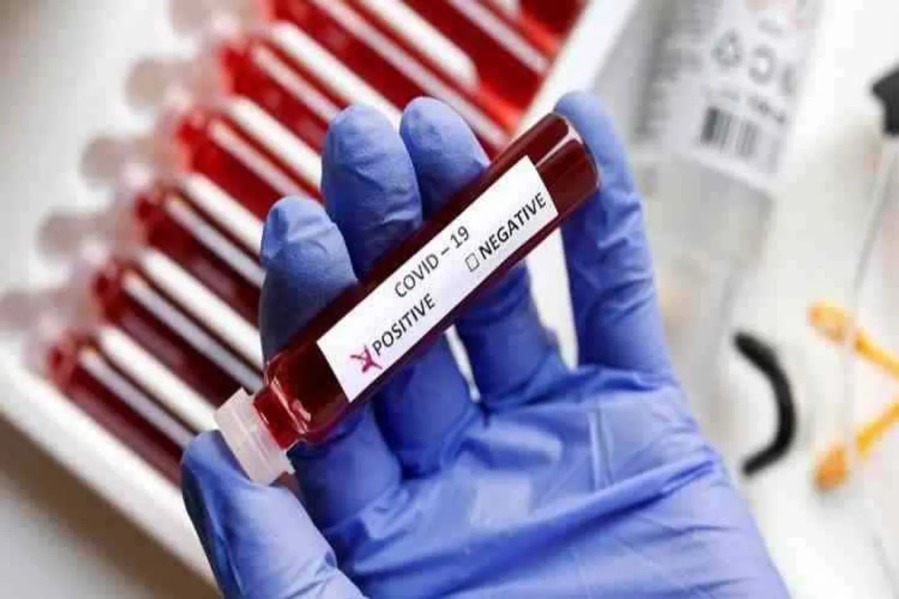 coronavirus daily report, covid-19 positive case today, today coronavirus case new record, கொரோனா வைரஸ், 2174 பேருக்கு கொரோனா வைரஸ் தொற்று, coronavirus death rate, tamil nadu coronvirus report, latest corona virus news, கோவிட்-19, கொரோனா வைரஸ் தினசரி ரிப்போர், tamil nadu today tested covid-19 positive 2174, total covid-19 positive cross 50000, tamil nadu coronavirus update