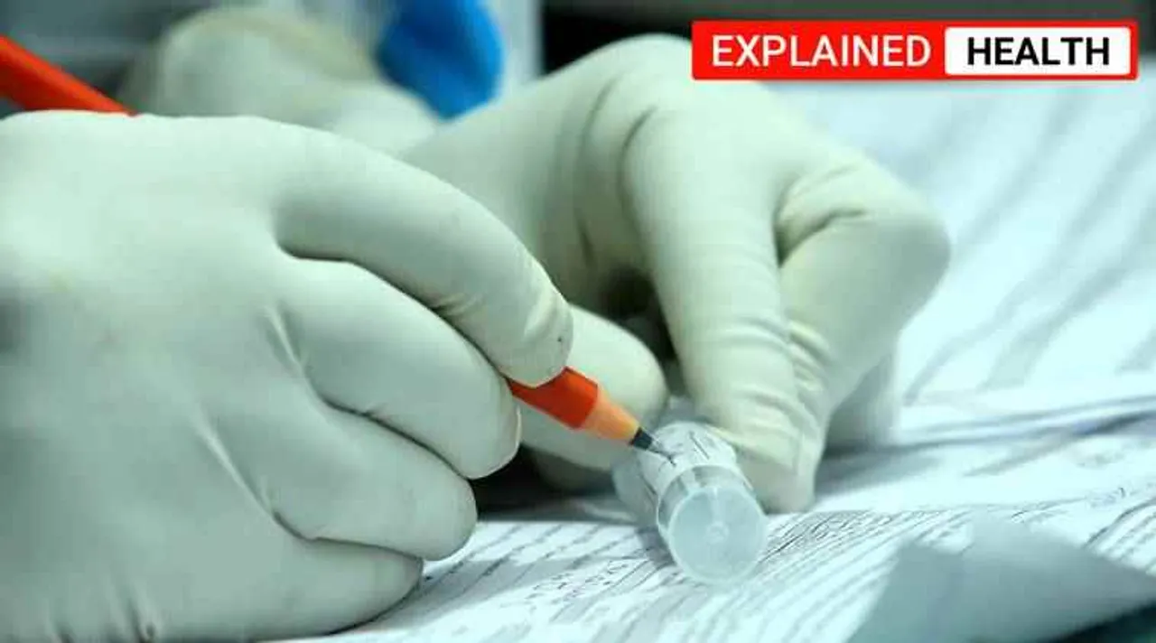 covid-19, blood test heart patients covid-19, கோவிட்-19, இதய நோயாளிகளுக்கு புதிய ரத்தப் பரிசோதனை, கொரோனா நோயாளிகளுக்கு சிகிச்சை, Blood test for heart patients, the University of Alberta, covid-19 blood test, Tamil indian express explained