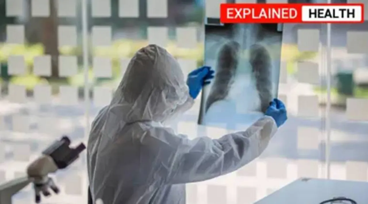 'inflammageing' என்றால் என்ன? கொரோனா பாதிப்பு தீவிரமாக இதுவும் காரணமா?