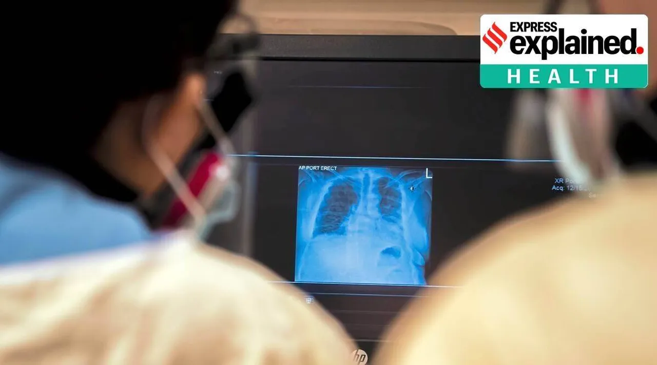 covid lung infection