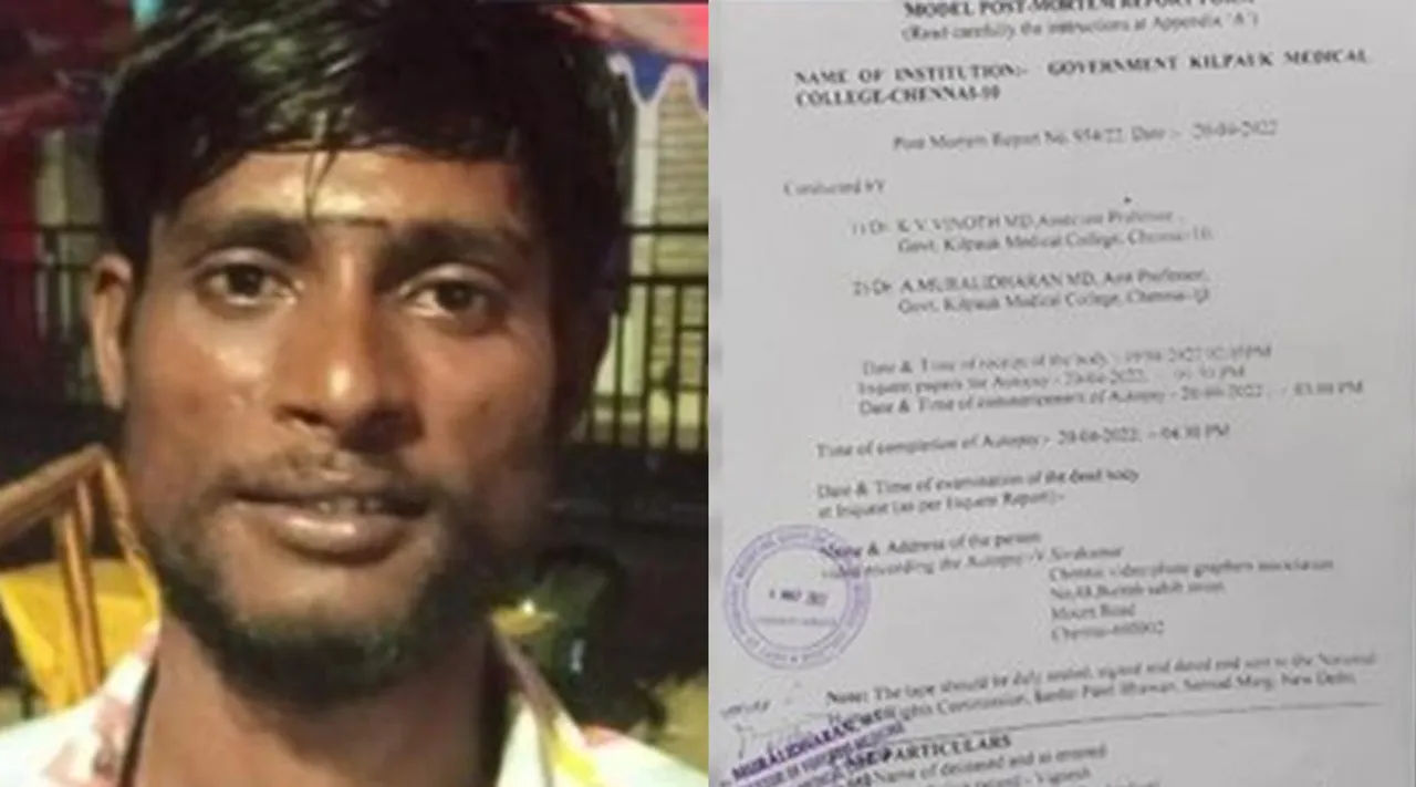 விசாரணை கைதி விக்னேஷ் உடலில் 13 இடங்களில் காயம்; உடற்கூறு ஆய்வில் அதிர்ச்சி தகவல் - lockup death Vignesh had several injuries on his body postmortem report