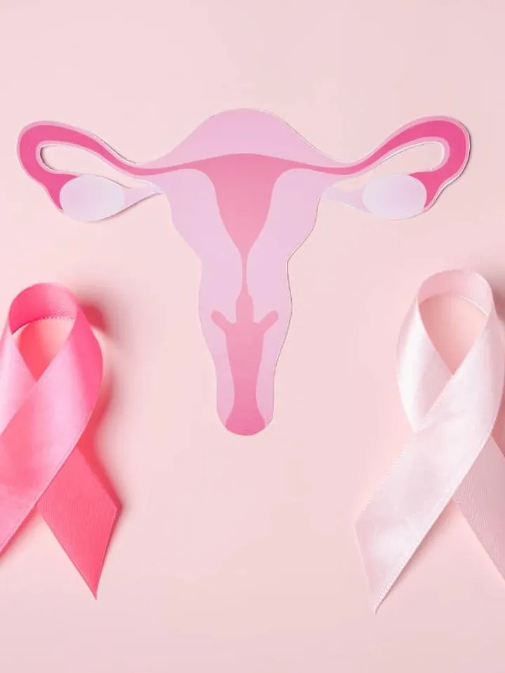 pcos