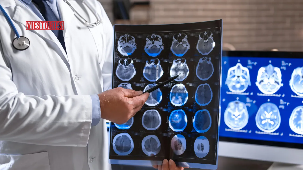 Neurologist Doctors in Prayagraj(Allahabad), UP