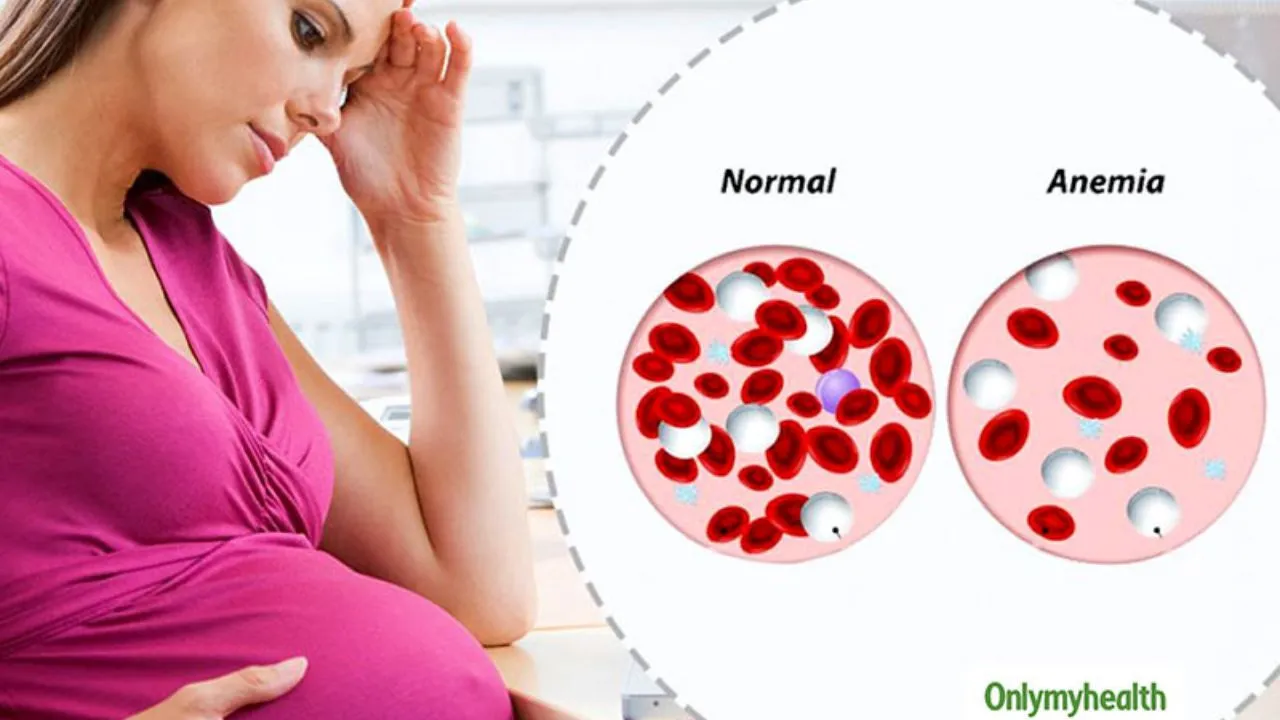 Anaemia