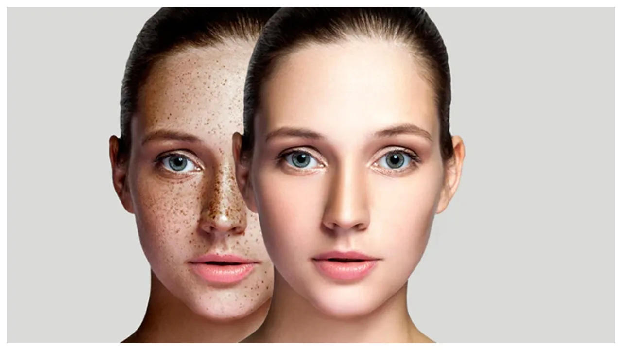 Dark Spots