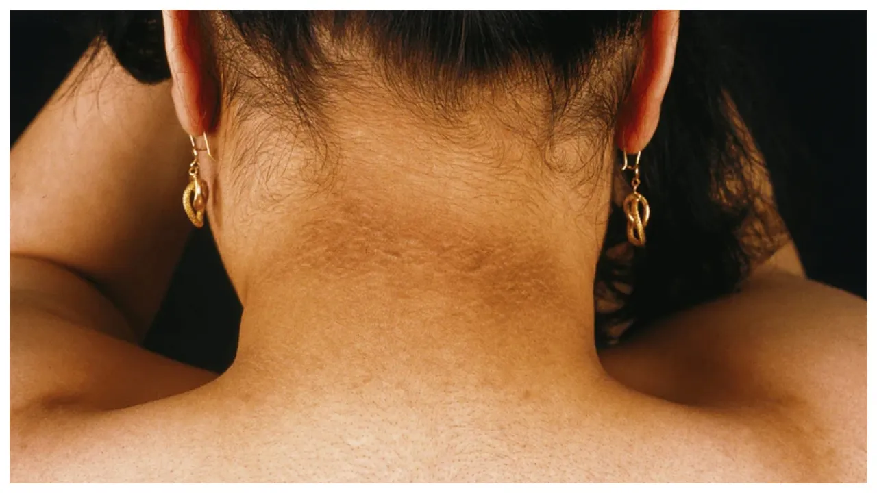 Black Neck