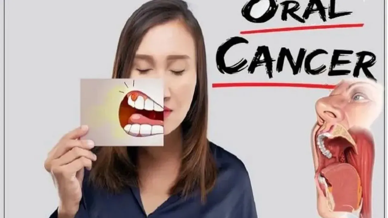 Oral Cancer