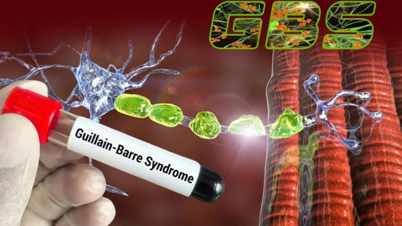 gbs 