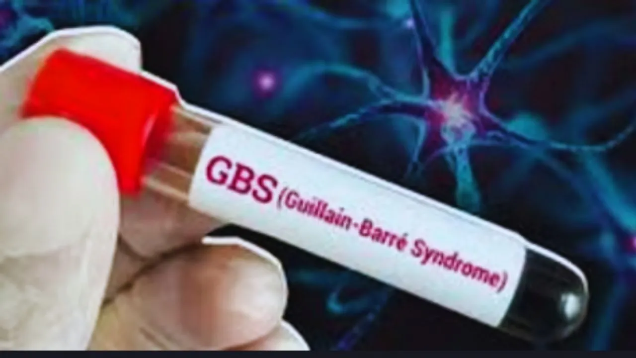 gbs, health news