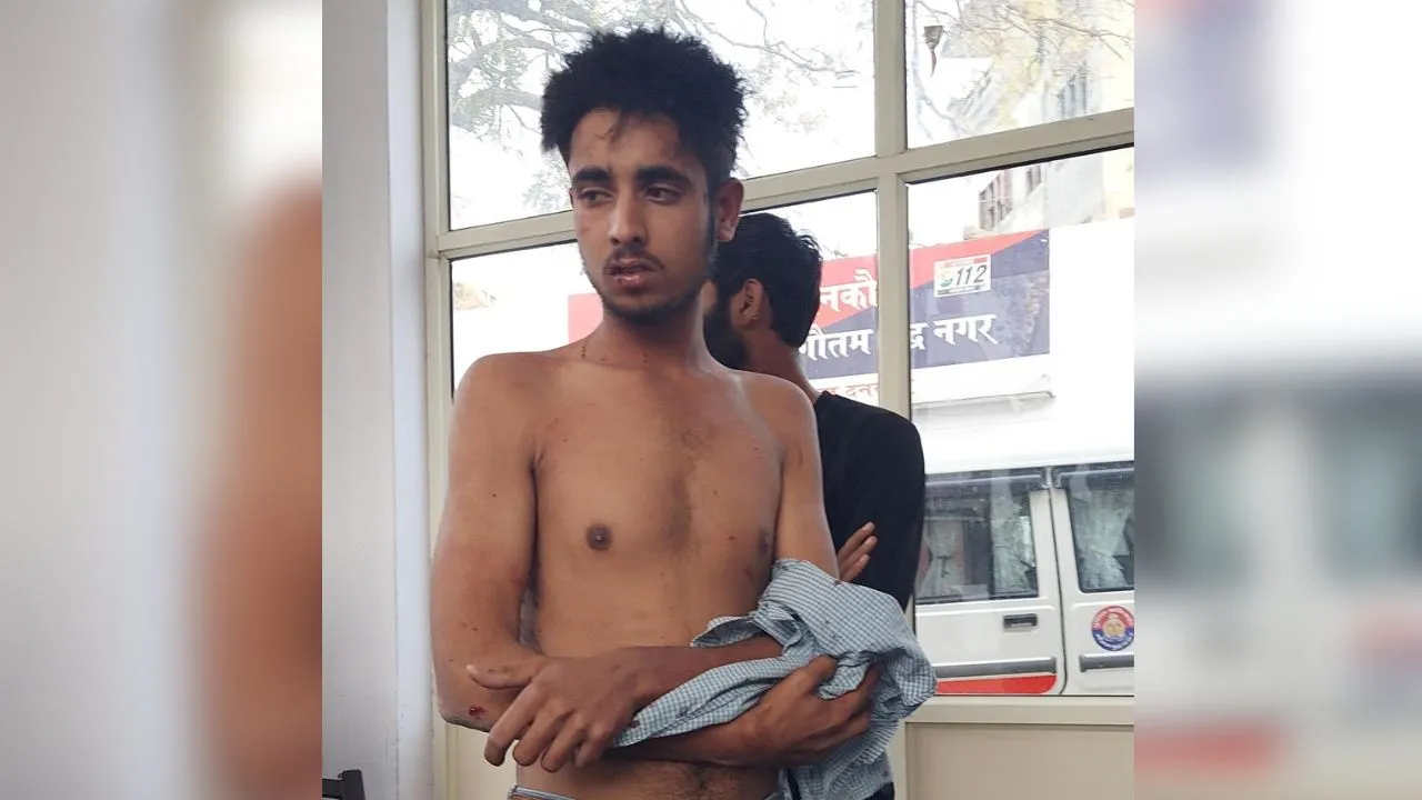 घायल छात्र