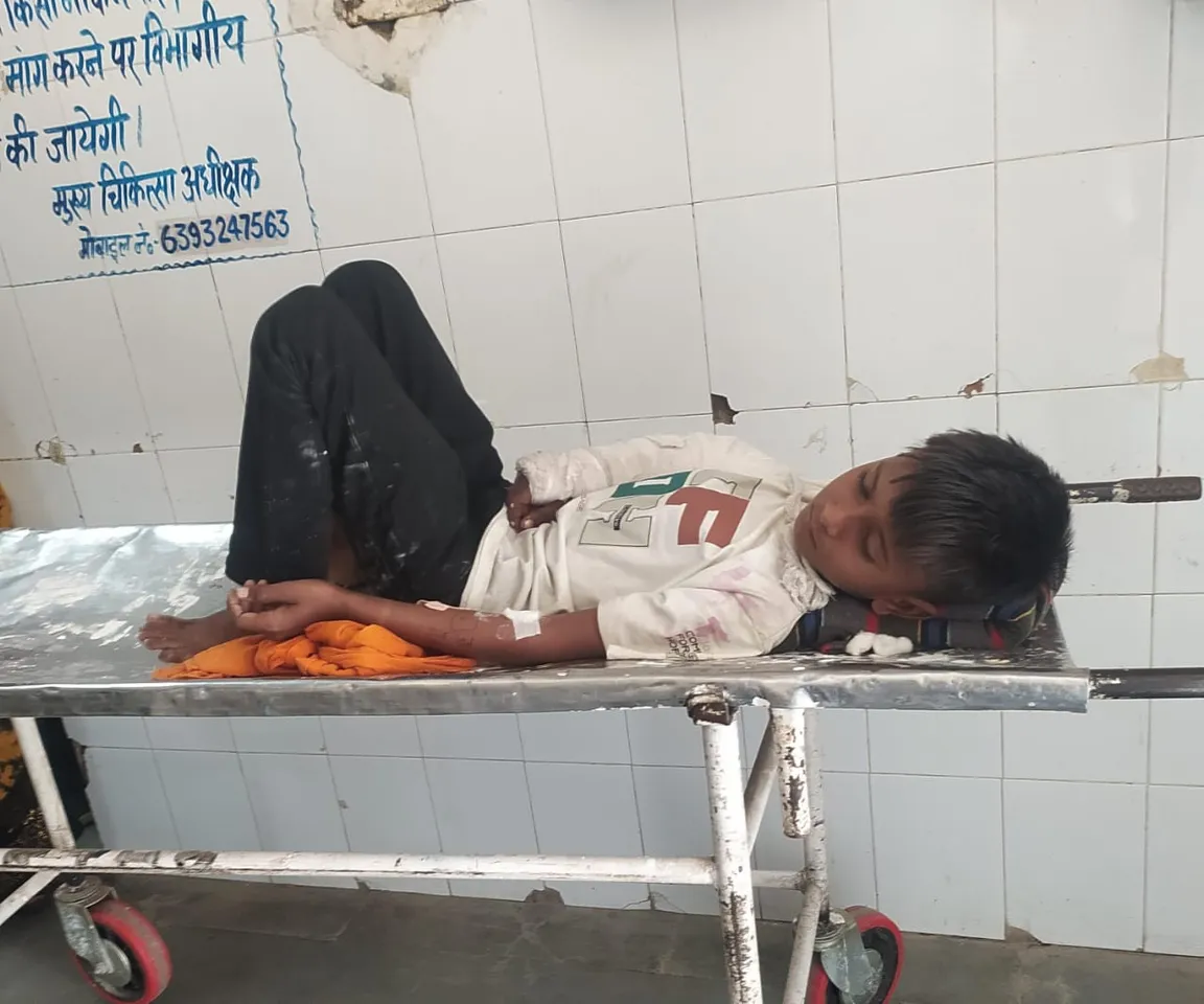 आवरा पशु हमला